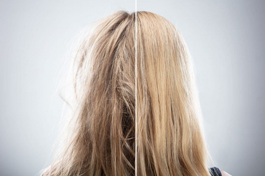 بوتاکس مو چیست و چند درصد صافی دارد؟